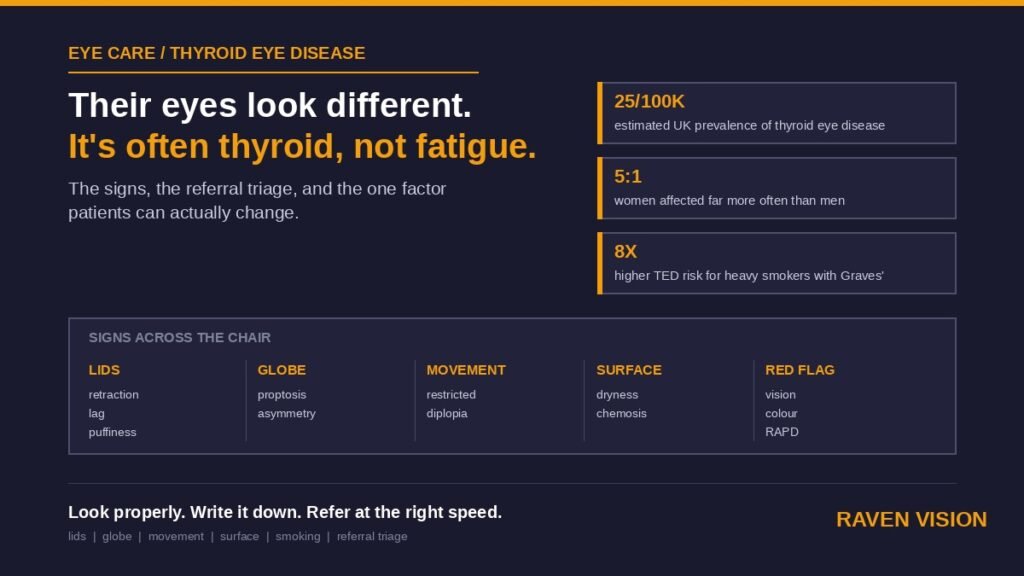 Thyroid Eye Disease: What UK Independent Opticians Should Recognise and When to Refer