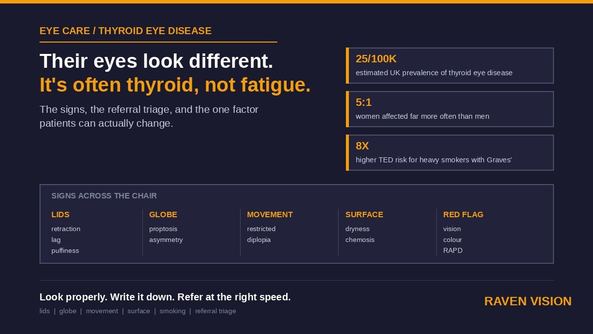 Thyroid Eye Disease: What UK Independent Opticians Should Recognise and When to Refer